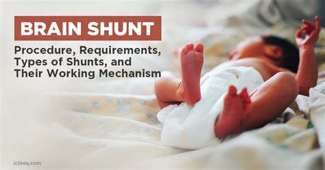 Brain Shunt | Procedure | Requirements | Types of Shunts | Their ...