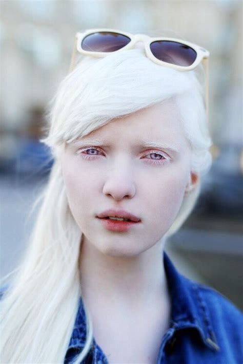 Nastya Zhidkova albino model with sunglasses | Albino girl, Albino model, Albino human