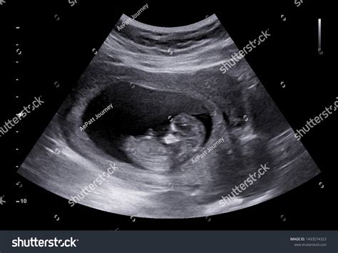 1,880 Baby Organs Stock Photos, Images & Photography | Shutterstock