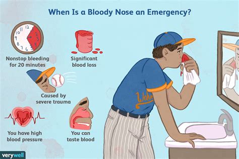 Bloody Nose Pregnancy Symptom - PregnancyWalls