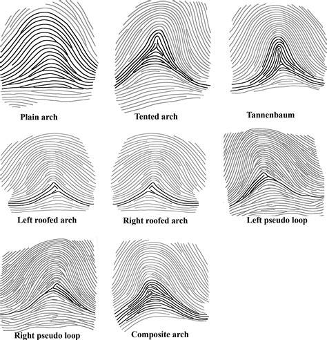 Ulnar Loop Fingerprint