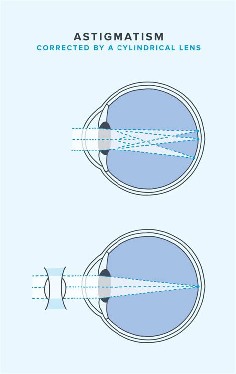 Descubrir 32+ imagen warby parker lenses for astigmatism - Viaterra.mx