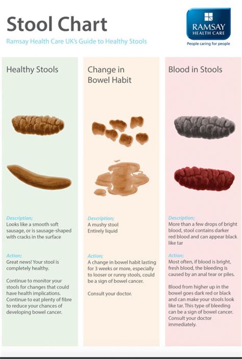 Bowel cancer symptoms: Signs include black stool - what a healthy poo ...