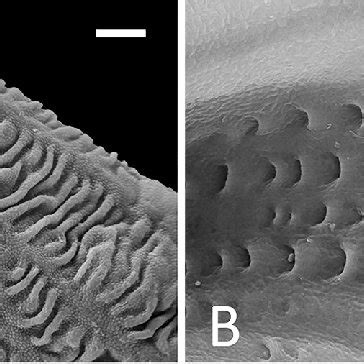 Morphology of androecium. A -Tipuana tipu, monadelphous androecium... | Download Scientific Diagram