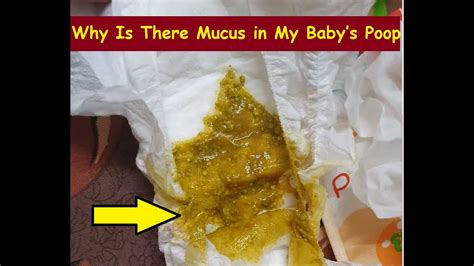 Why Is There Mucus in My Baby’s Poop? - YouTube