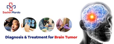 Diagnosis & Treatment for Brain Tumor | Sachin Marda | Best Cancer Specialist in Hyderabad