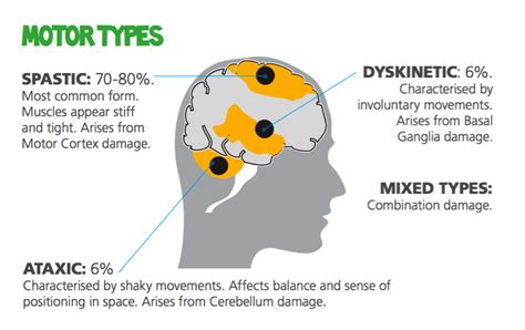 Four Types Of Cerebral Palsy