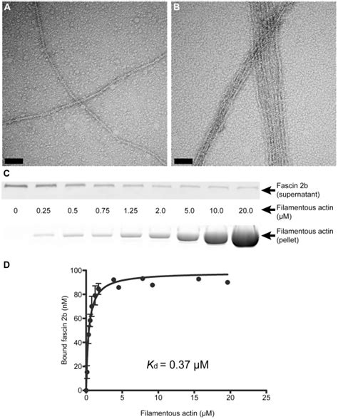 Negative staining and electron microscopy reveal actin bundling by... | Download Scientific Diagram