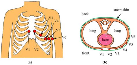 Ekg Electrode Placement