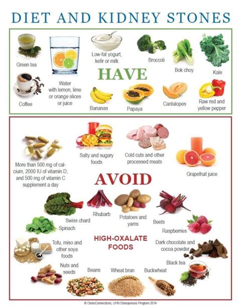 Kidney stone diet chart – Printable graphics