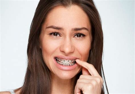 Ways to Ease Braces Pain - Omar Orthodontics