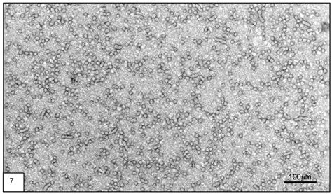 Negative And Positive Staining In Transmission Electron, 43% OFF