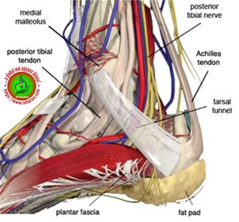 Tarsal Tunnel Syndrome - Symptoms, Diagnosis, Treatment - Rxharun