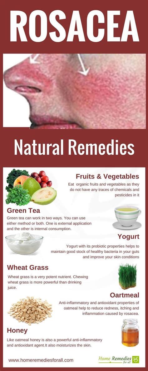 Get rid of Rosacea quickly with the use of these home remedies regularly and get | Natural ...