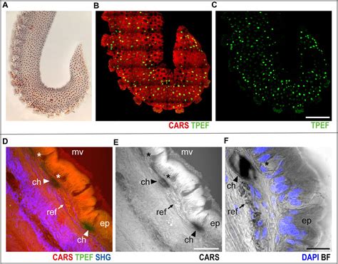 Frontiers | Imaging Arm Regeneration: Label-Free Multiphoton Microscopy to Dissect the Process ...