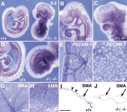 The murine winged helix transcription factors, Foxc1 and Foxc2, are both required for ...