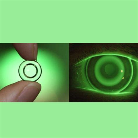 Things To Know About Ortho K Lenses And Corneal Reshaping - Vision Space Official website