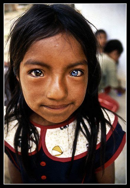 "heterocromía" strange but beautiful eyes | Pretty eyes, Rare eyes ...