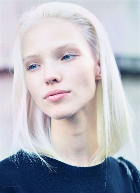 Photo | Tumblr | Albino girl, Pretty face, Hair trends