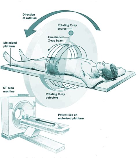 Ct Scan Diagram