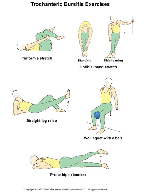 Trochanteric Bursitis Exercises