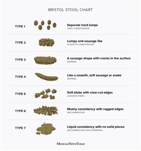 Types of poop: Appearance, color, and what is normal