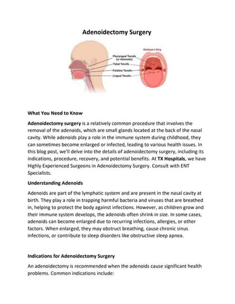 Adenoidectomy Surgery.pdf