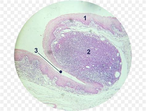 Tonsil Adenoid Epithelium Lingual Artery Histology, PNG, 662x622px ...