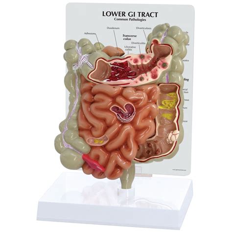 Lower GI Tract - Digestive System - Human Anatomy - Biology