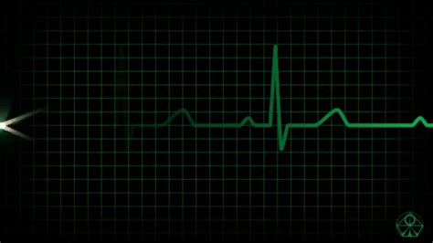 Ecg Animation Download - Videohive , After Effects,Pro Video Motion