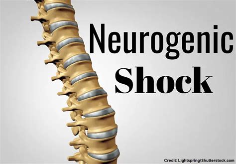 Neurogenic shock - Cause, Symptoms, Treatment - Mobile Physio