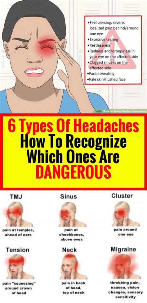 6 Headaches Types: How To Recognize Which Types Are Dangerous # ...