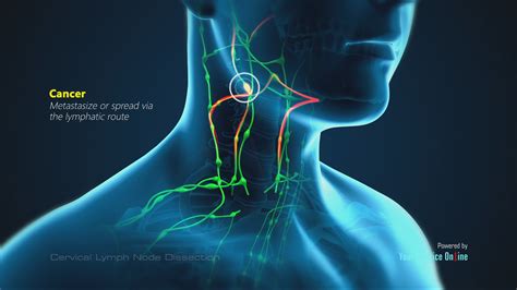 Jugular Lymph Nodes