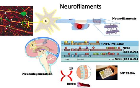 Barts Health CSF Neurofilament light chain (NfL) request – The MS-Blog