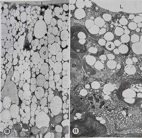 CHANGES IN FINE STRUCTURE DURING SILK PROTEIN PRODUCTION...The Journal of Cell Biology - Dr ...