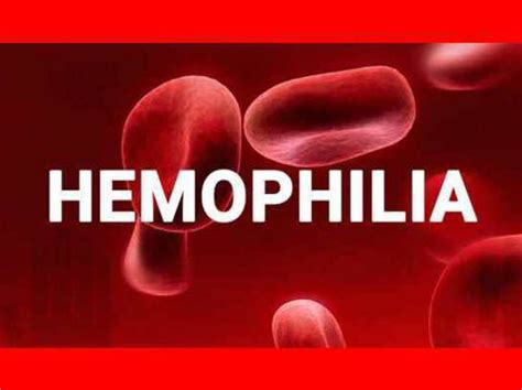 Homeopathy Used For Haemophilia | Homeopathy Plus