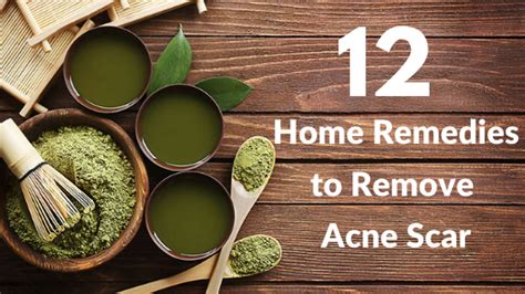 Home remedies for Acne | Tibot