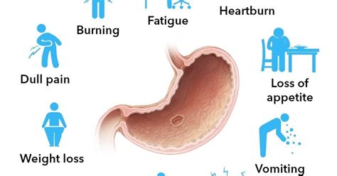 What are the Symptoms of Stomach Ulcer? [Infographic]