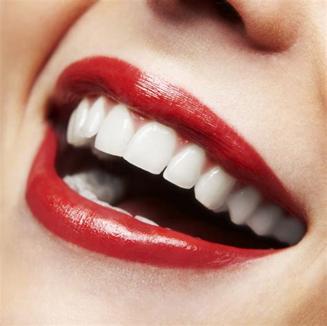 Steps in Creating a Beautiful Smile | Aesthetic Advantage - Aesthetic Dental Education ...