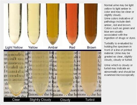 brown urine with sediment