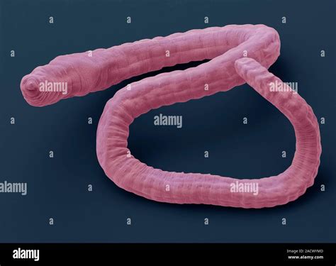 Tubifex worm, coloured scanning electron micrograph (SEM). Tubifex ...