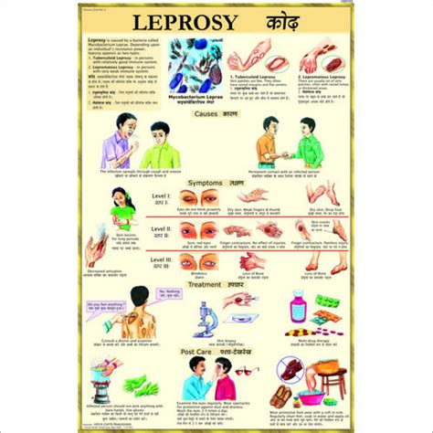 Leprosy Treatment Chart Dimensions: 70 X 100 Centimeter (cm) at Best Price in Delhi | Vidya ...