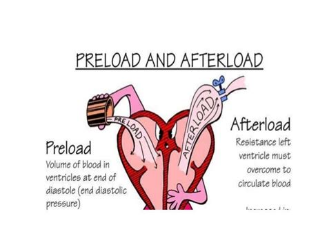 Hypovolemic shock ( related cardiac output)