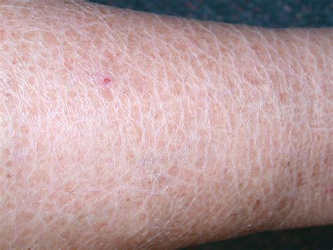 Scaly Skin: Causes and Dealing Ways | New Health Advisor