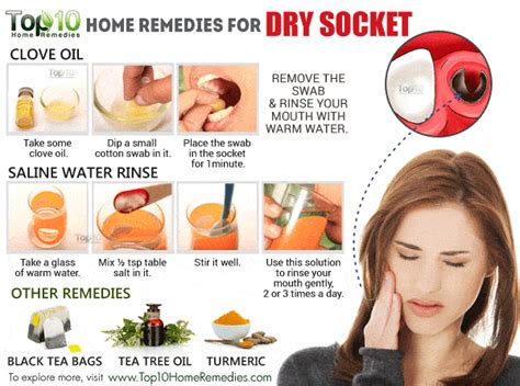 Home Remedies for Dry Socket | Top 10 Home Remedies