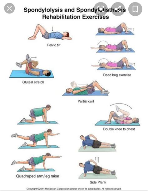 Physical Therapy Exercises For Lumbar Scoliosis Exercise Poster – NBKomputer