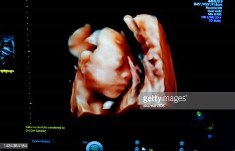 22 Weeks Pregnant Ultrasound Photos and Premium High Res Pictures - Getty Images