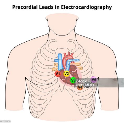 Precordial Leads In Electrocardiography V1 V2 V3 V4 V5 And V6 Position ...