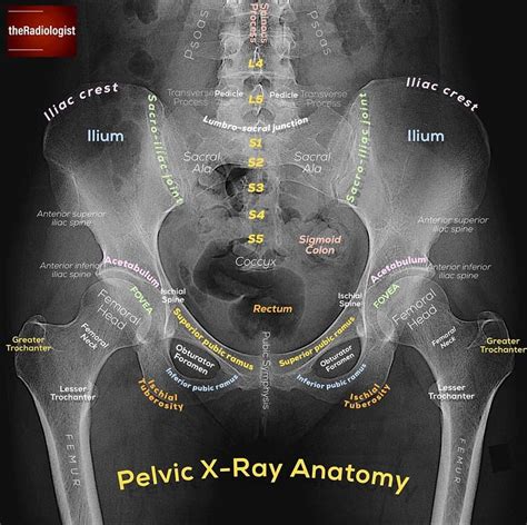 Pelvic X-ray Anatomy #Ashiry - Radiology Students Of A.M.S