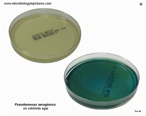 Cetrimide agar. Growth of Pseudomonas aeruginosa on cetrimide agar plate. Petri dish with ...